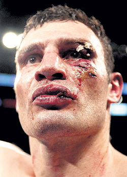 Виталия били по голове - это многое объясняет