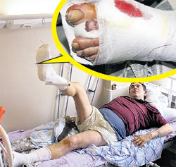 ПОСЛЕ ОПЕРАЦИИ: героизм привёл актёра на больничную койку